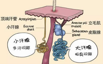 青岛皮肤病医院介绍腋臭是因为遗传吗?